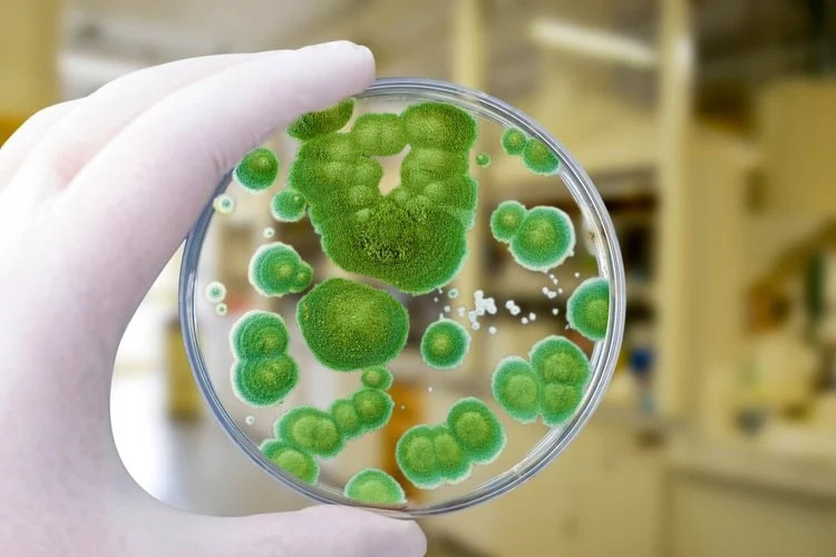 scientist viewing microbes growth on lab